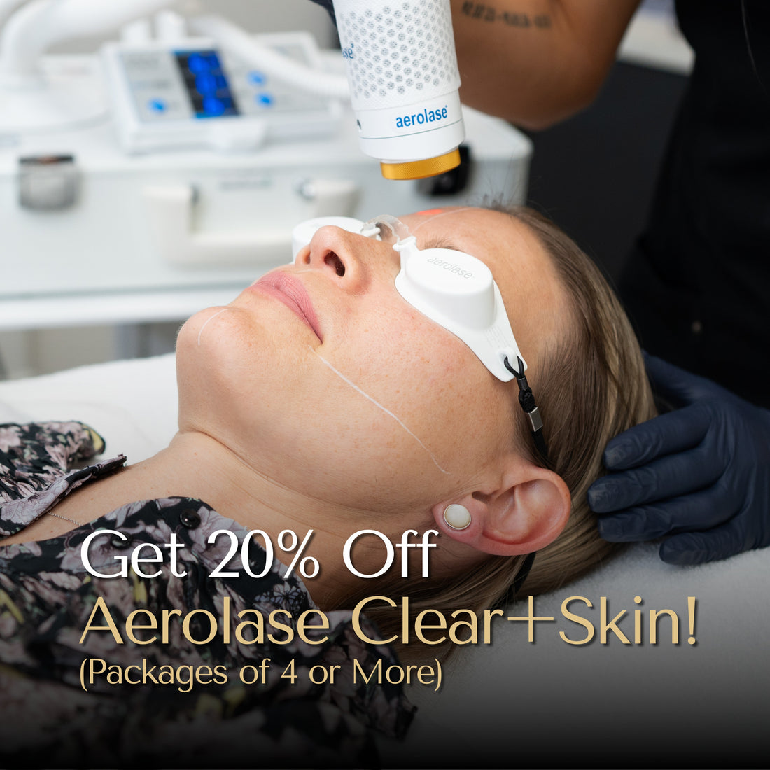 *Aerolase CLEAR Skin Treatment - Skin Secrets